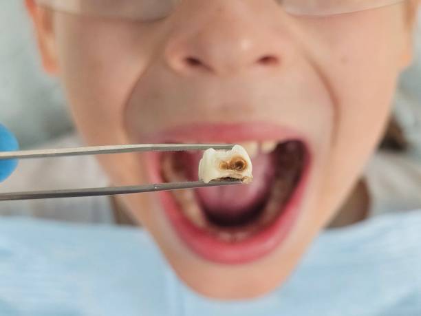 Best Emergency Dental Services for Seniors in Mckenzie, TN