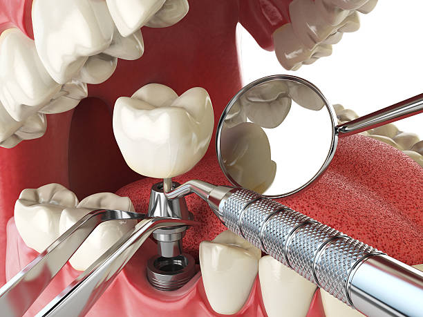 Best Broken or Cracked Tooth Emergency Dentist in Mckenzie, TN
